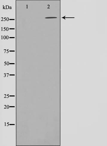 Acetyl-CoA Carboxylase / ACC Antibody (phospho-Ser80)