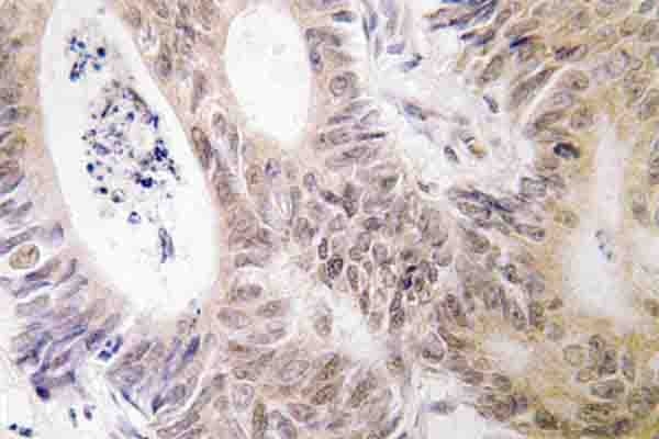 Polyclonal Rabbit anti-Human RPS6KA5 / MSK1 Antibody (Asp205, IHC, WB)