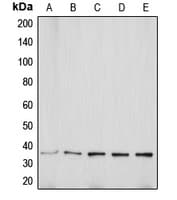 Polyclonal Rabbit anti-Human AQP5 / Aquaporin 5 Antibody (C-Terminus, IHC, WB)