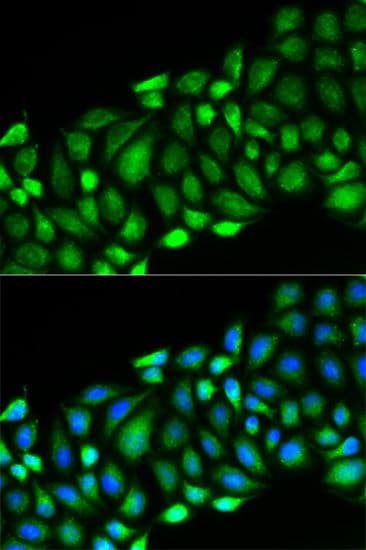 RICK / RIP2 Antibody