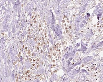 VPS72 Antibody