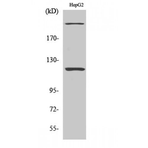 ZNF638 Antibody (1240-1320 aa, Internal)