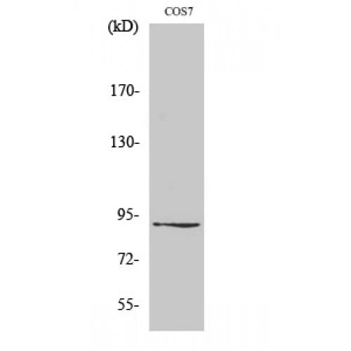 Polyclonal Rabbit anti-Human ZC3H11A Antibody (260-340 aa, Internal, WB)