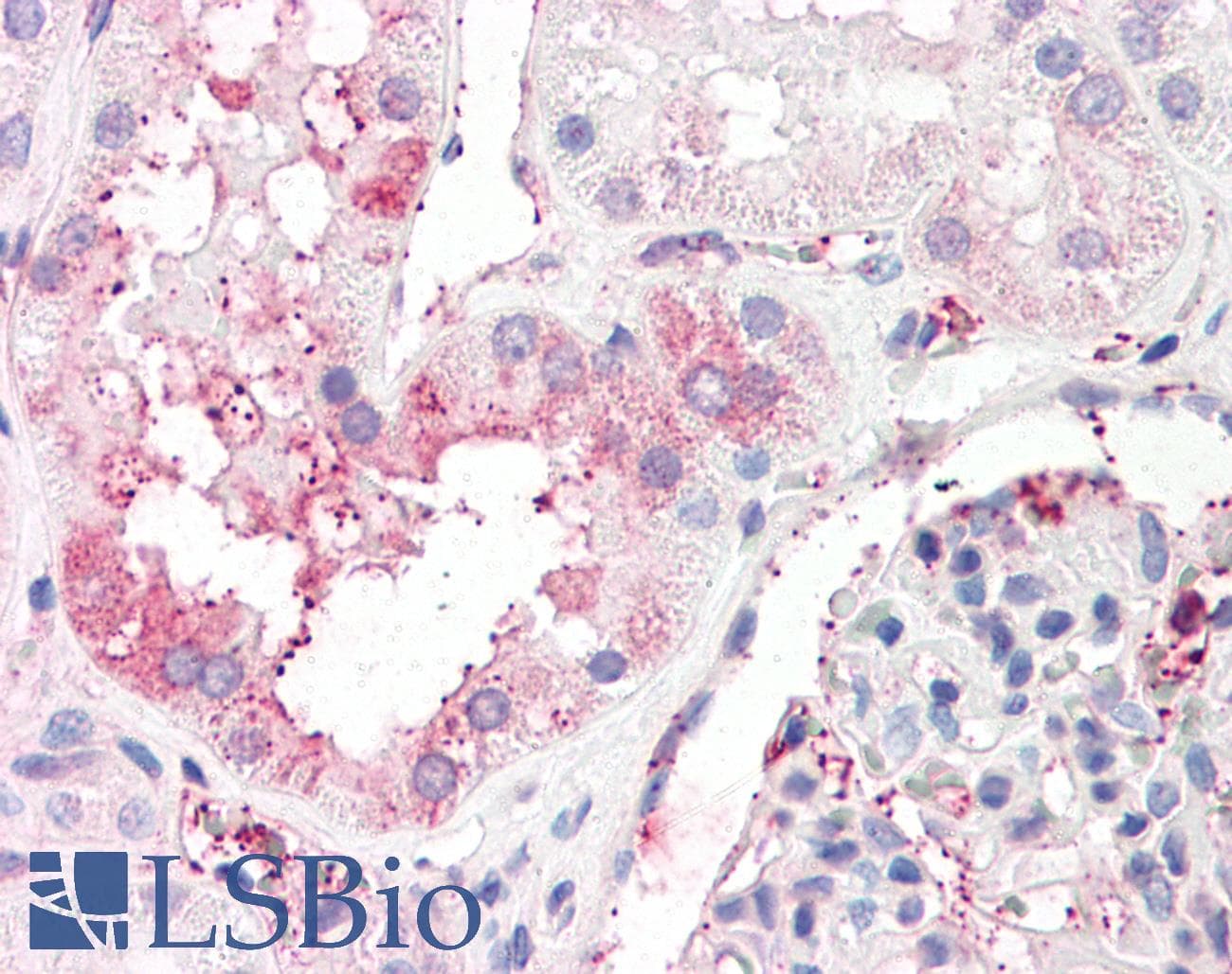 IHC-plus™ Polyclonal Rabbit anti-Human C14orf1 Antibody (Internal, IHC)