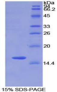 Rat MGP / Matrix Gla-Protein (Recombinant His-T7)