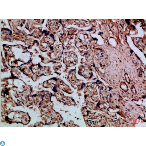CSTB / Cystatin B / Stefin B Antibody