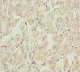 Polyclonal Rabbit anti-Human SOCS4 Antibody (IHC, WB)