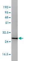 IHC-plus™ Monoclonal Mouse anti-Human CD58 Antibody (clone 2D11-B10, IHC, IF, WB)