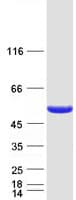 Human DBT / E2 Protein (Recombinant Myc-DDK (Flag))