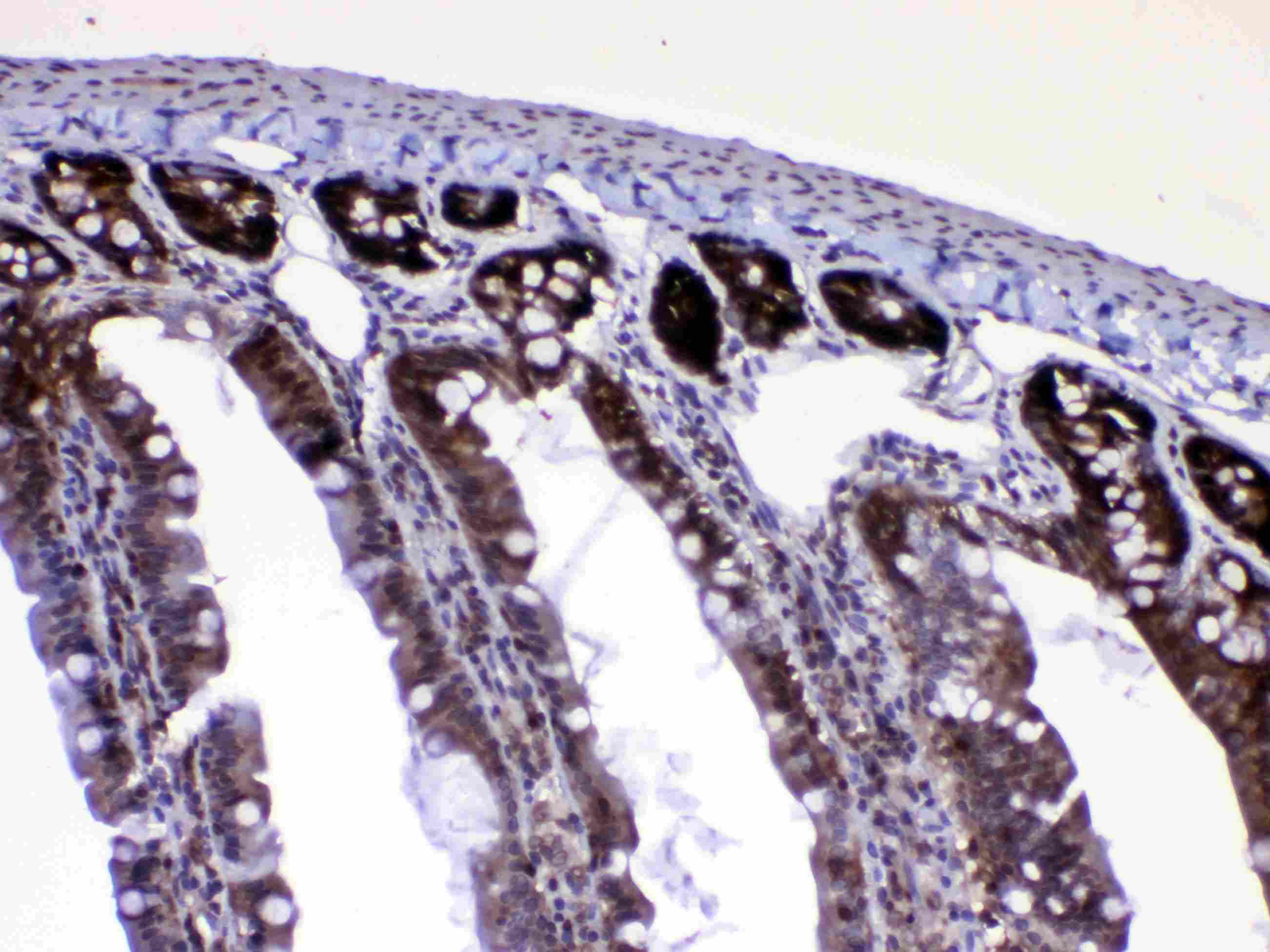 RAN Antibody