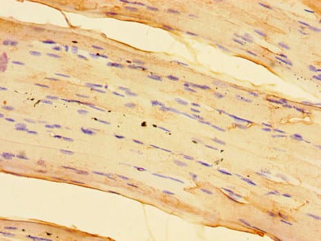 SPHK / SPHK1 Antibody