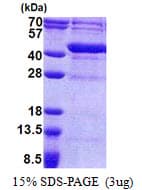 Human UPRT Protein (Recombinant His)