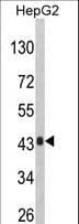 IHC-plus™ AGXT / SPT Antibody (aa96-125)
