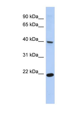 SSBP4 Antibody (C-Terminus)