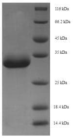 Crab-eating macaque EPO / Erythropoietin Protein (Recombinant 6His-SUMO, N-terminus)