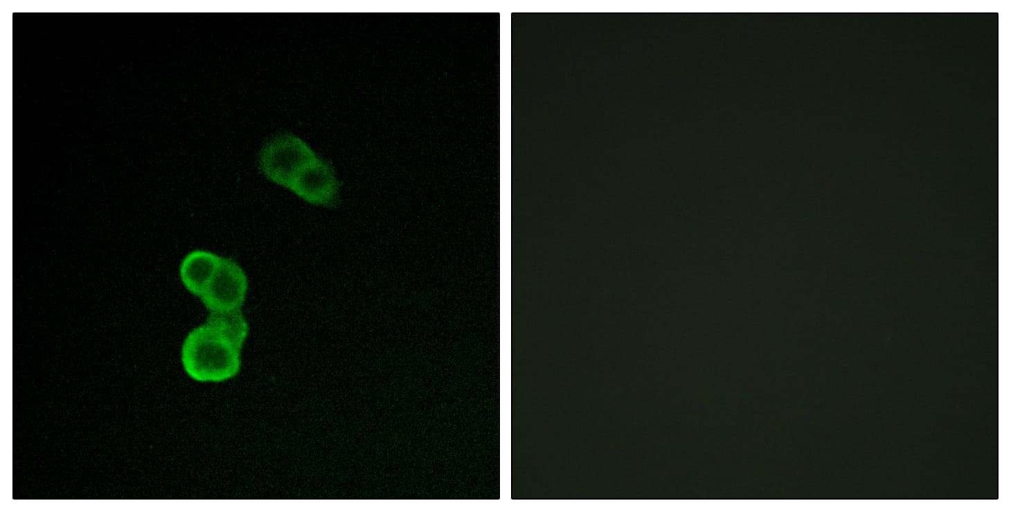 Polyclonal Rabbit anti-Human GAP43 Antibody (phospho-Ser41, IF)
