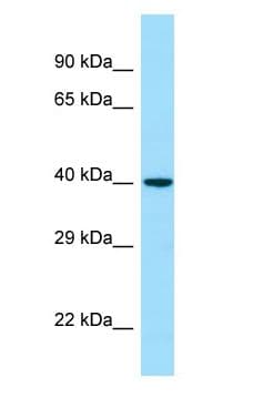 Polyclonal Rabbit anti-Human NOXO1 Antibody (aa161-210, WB)