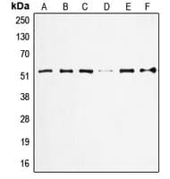TP53 / p53 Antibody (N-Terminus)