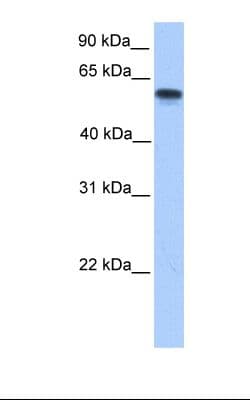 Polyclonal Rabbit anti-Human P450SCC / CYP11A1 Antibody (aa288-337, IHC, WB)