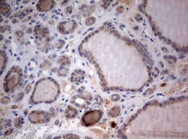 STK11 / LKB1 Antibody (aa1-236, clone OTI0A3)