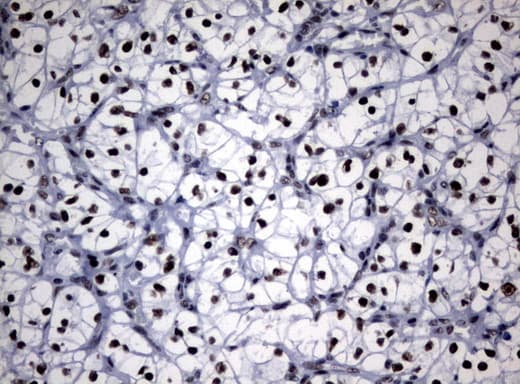 Monoclonal Mouse anti-Human NBN / Nibrin Antibody (clone UMAB100, aa183-460, IHC, IF, WB)