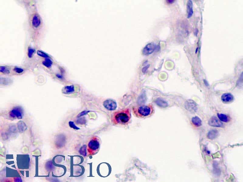 IHC-plus™ SFTPC / Surfactant Protein C Antibody (aa144-173)
