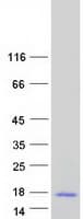 Human KRTDAP Protein (Recombinant Myc-DDK (Flag))