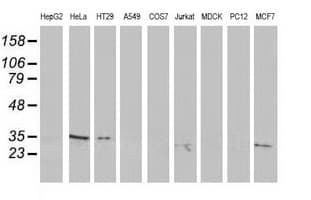 RTFDC1 Antibody (clone OTI7E10)