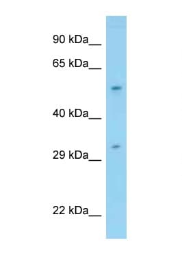 Polyclonal Rabbit anti-Human PPP1R16B Antibody (aa57-106, WB)