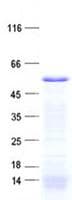 Human ZNF621 Protein (Recombinant His, N-Terminal)