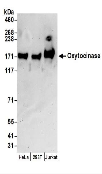 IHC-plus™ Polyclonal Rabbit anti-Human LNPEP Antibody (aa1-50, IHC, WB)
