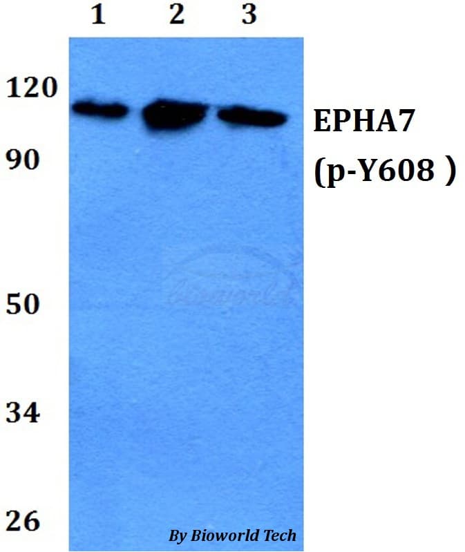 Polyclonal Rabbit anti-Human EPHA7 / EPH Receptor A7 Antibody (phospho-Tyr608, WB)
