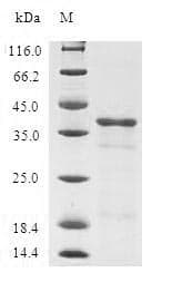 Human TUSC2 / FUS1 Protein (Recombinant GST, N-terminus)