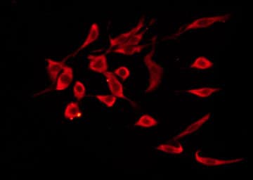 Prostaglandin D2 Receptor Antibody