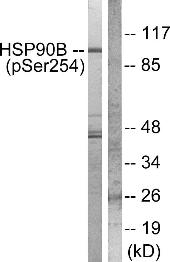 NFKBIB / IKB Beta / IKBB Antibody (phospho-Ser23)