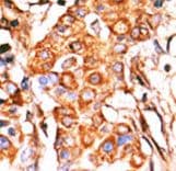 GK2 / Glycerol Kinase 2 Antibody (aa487-515)