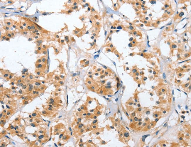 Polyclonal Rabbit anti-Human UGCG Antibody (IHC)