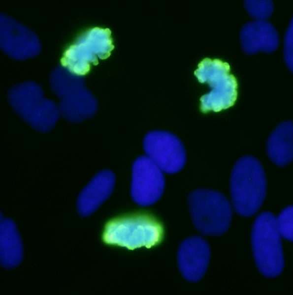 HIST1H3A Antibody (phospho-Ser10)