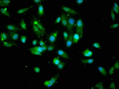 AKT1 Antibody