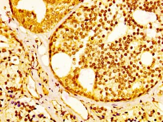 SLC45A3 / Prostein / p501S Antibody