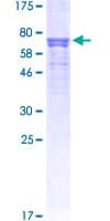 Human AGT / Angiotensinogen Protein (Recombinant GST)