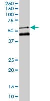 Monoclonal Mouse anti-Human MEIS2 Antibody (clone 1H4, IHC, IF, WB)