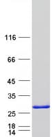 Human RBM42 Protein (Recombinant Myc-DDK (Flag))