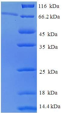 Human EPHX1 / Epoxide Hydrolase 1 Protein (Recombinant His-SUMO)