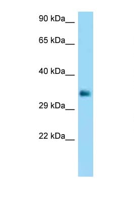 CD32B Antibody (C-Terminus)