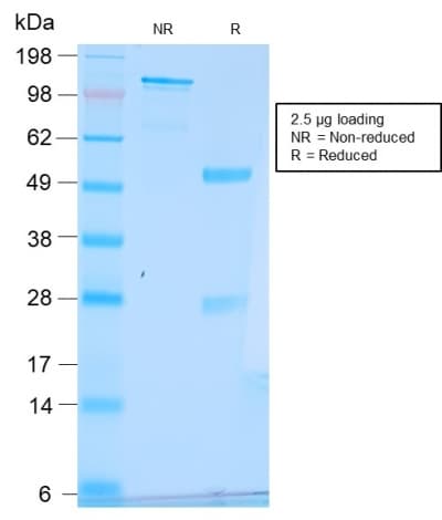 PathPlus™ Recombinant Monoclonal Rabbit anti-Human TFF1 / pS2 Antibody (clone TFF1/2969R, aa50-100, IHC)