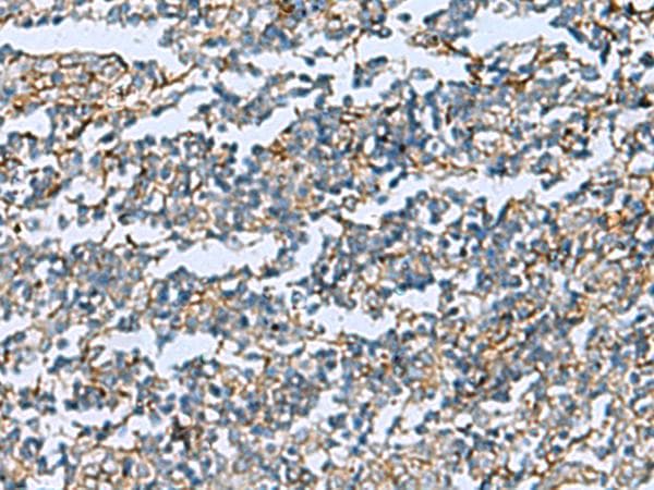 Polyclonal Rabbit anti-Human DPYSL3 / CRMP4 Antibody (IHC)