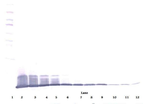 IL8 / Interleukin 8 Antibody