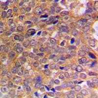 ABL Antibody (phospho-Tyr393/Tyr439)
