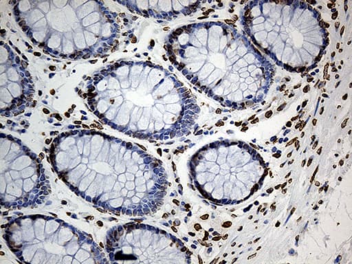 Monoclonal Mouse anti-Human SLU7 / 9G8 Antibody (clone OTI5A7, aa1-300, IHC, WB)